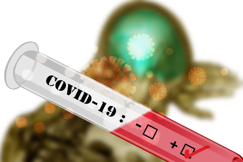 covid-19, coronavirus, sars-cov-2